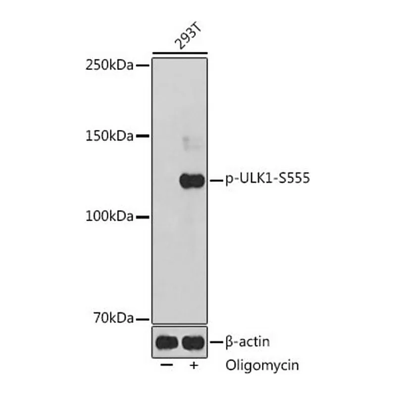 Merck Anti-Phospho-ULK1-S555 antibody produced in rabbit