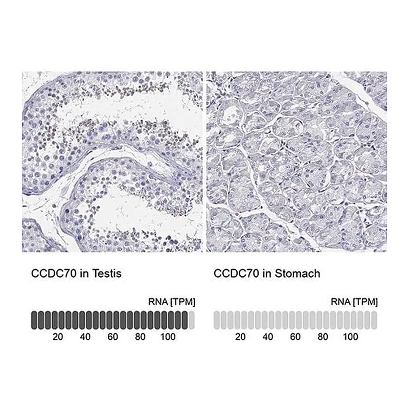 Merck Anti-CCDC70 antibody produced in rabbit