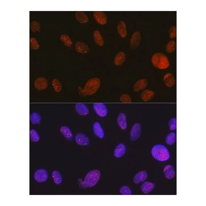 Merck Anti-SMARCA5/SNF2H antibody produced in rabbit