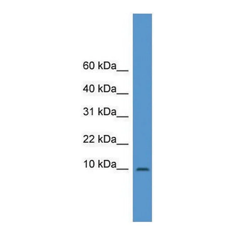 Merck Anti-IAPP (N-terminal) antibody produced in rabbit