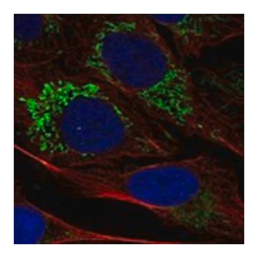 Merck Anti-TSPO antibody produced in rabbit