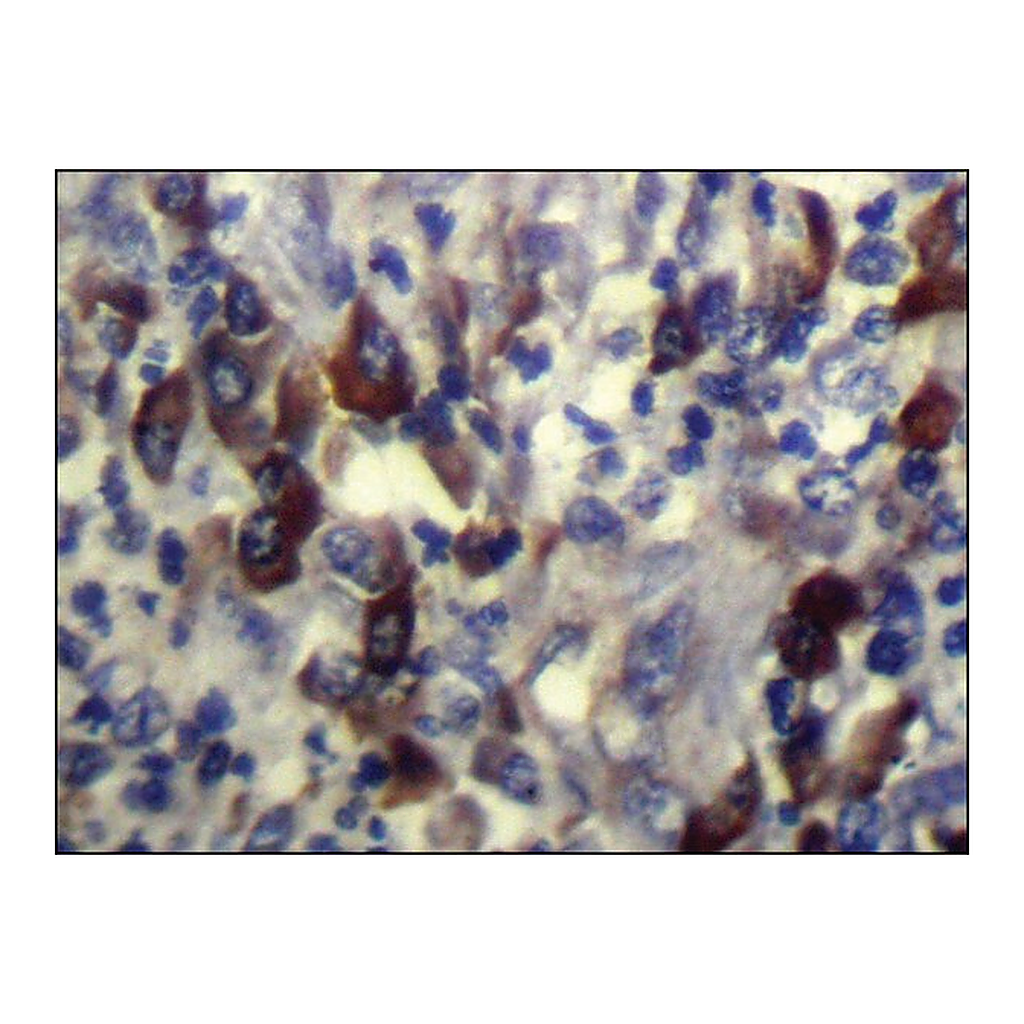 Merck Anti-CARTPT