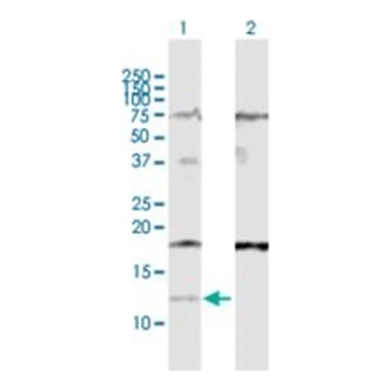 Merck ANTI-IFI27