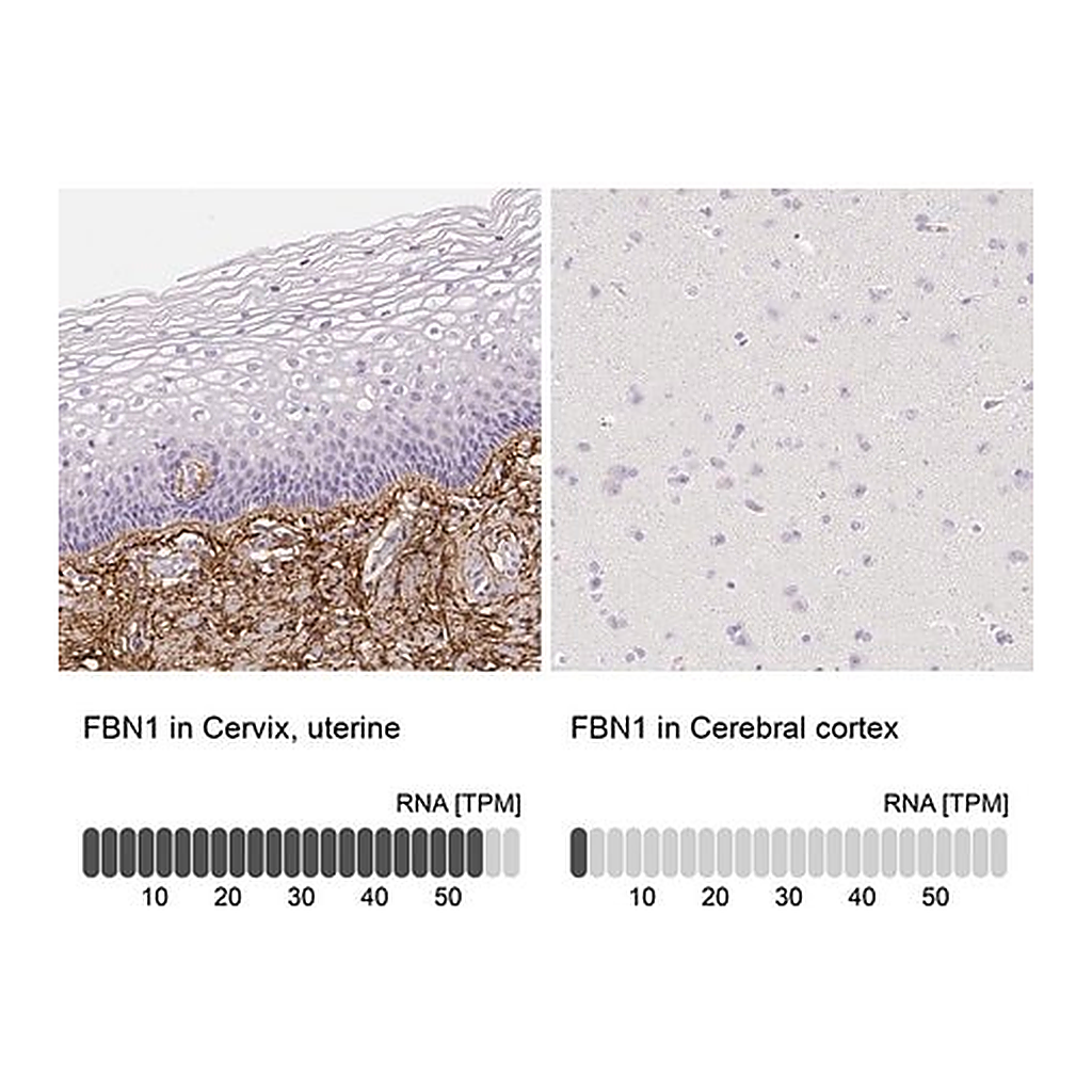 Merck Anti-FBN1 antibody produced in rabbit