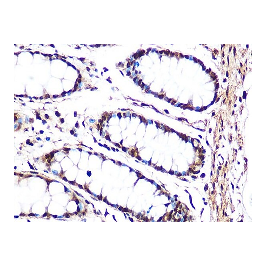 Merck Anti-JNK1 antibody produced in rabbit