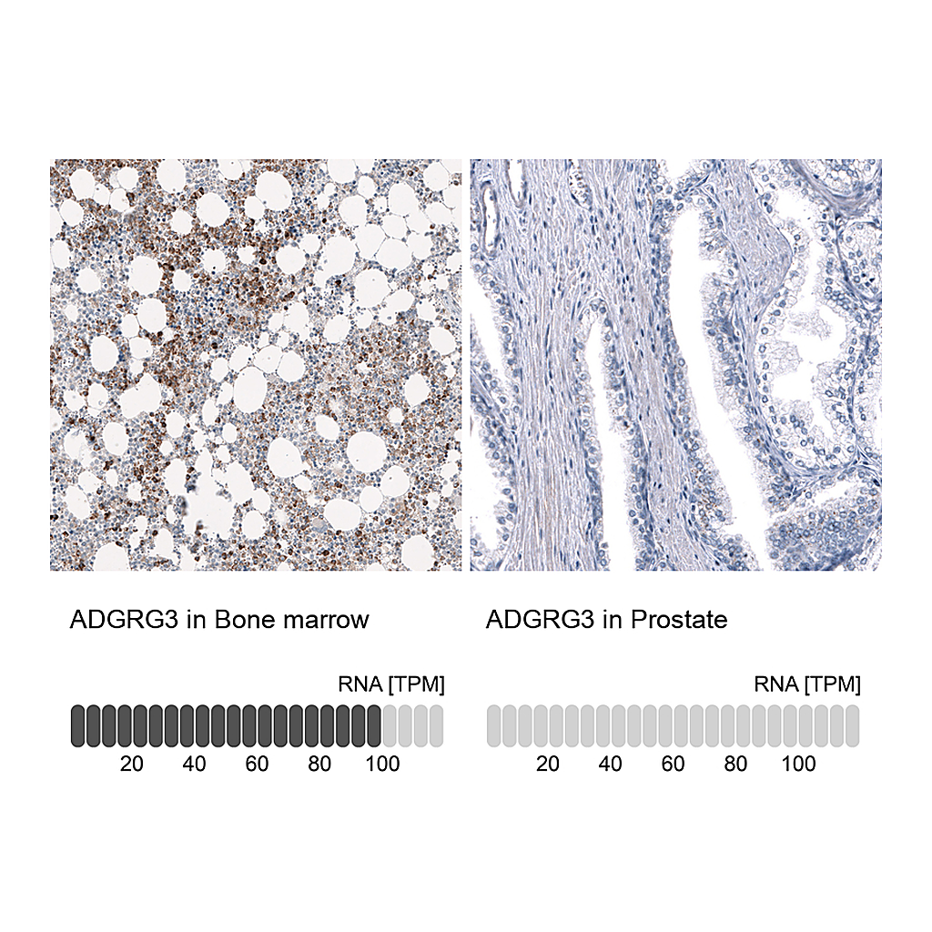 Atlas Antibodies Anti-ADGRG3 Antibody