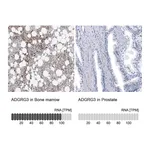 Atlas Antibodies Anti-ADGRG3 Antibody