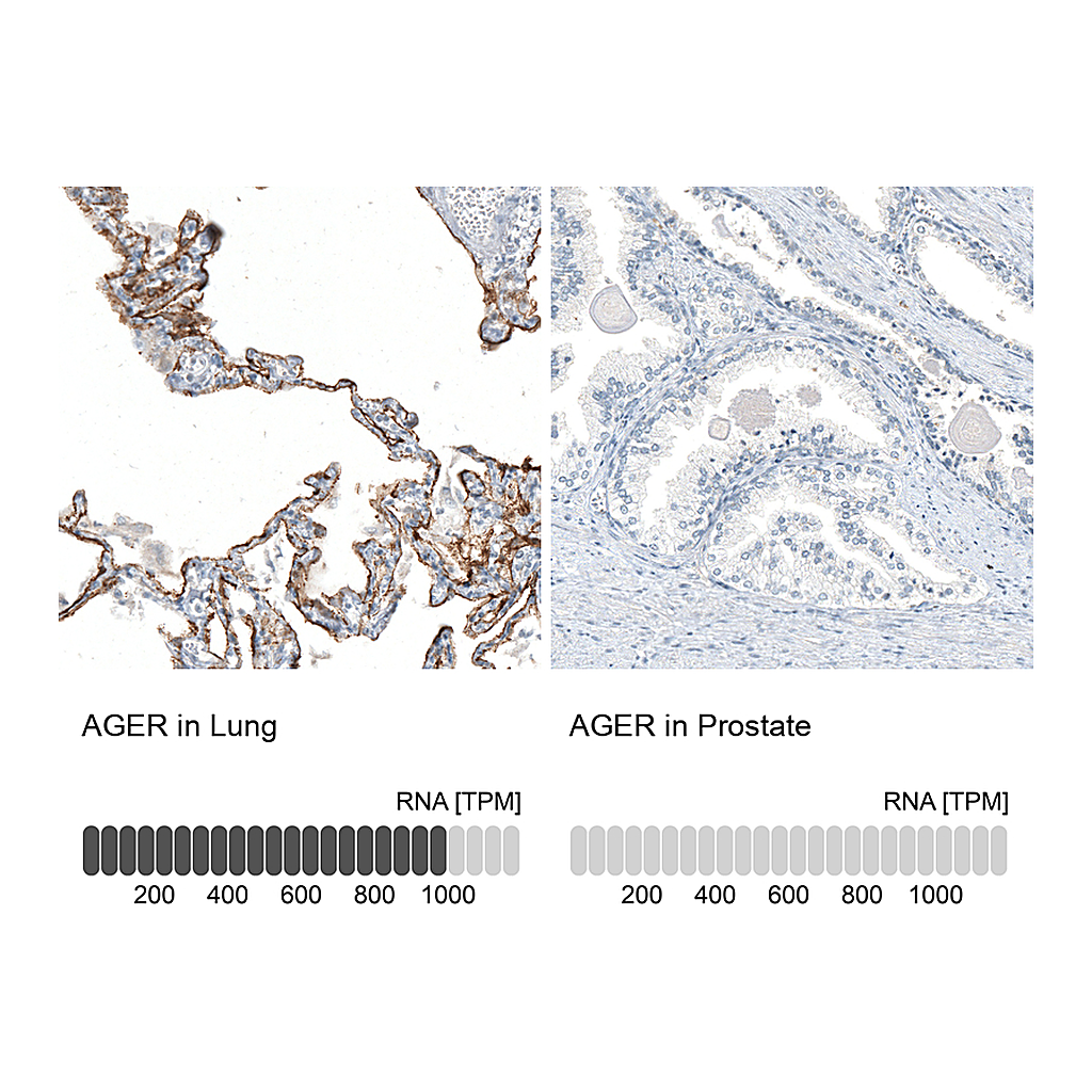 Atlas Antibodies Anti-AGER Antibody