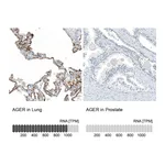 Atlas Antibodies Anti-AGER Antibody