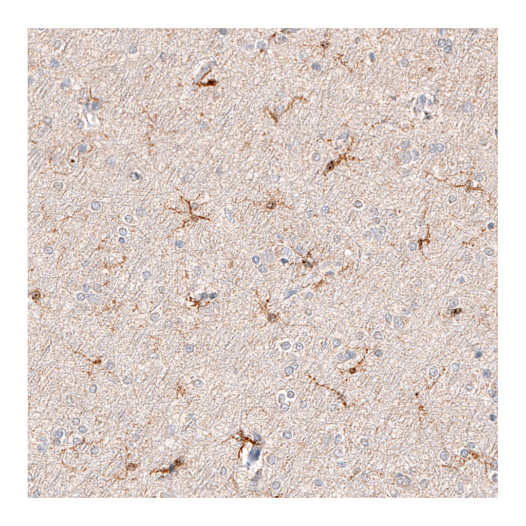 Atlas Antibodies Anti-AIF1 Antibody