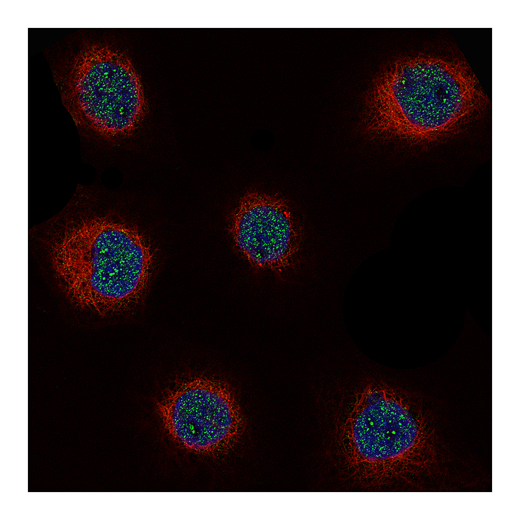 Atlas Antibodies Anti-CCND1 Antibody