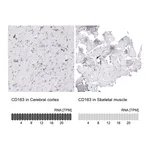 Atlas Antibodies Anti-CD163 Antibody