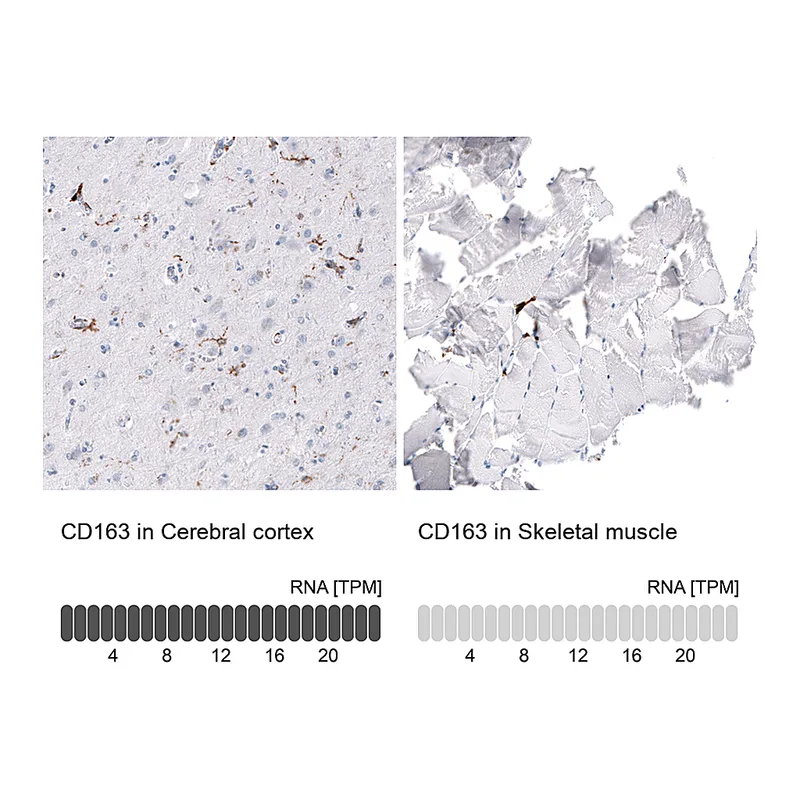 Atlas Antibodies Anti-CD163 Antibody