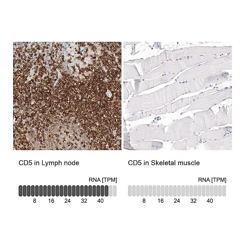 Atlas Antibodies Anti-CD5 Antibody
