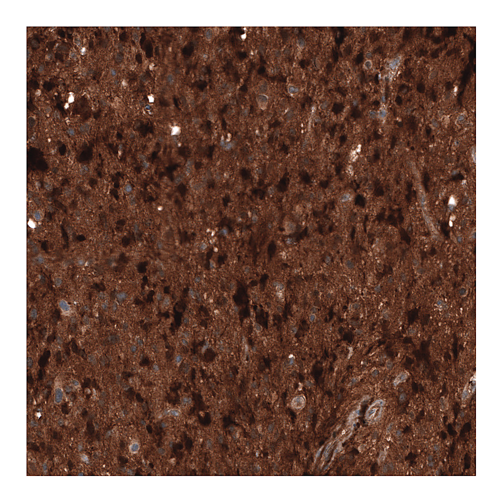 Atlas Antibodies Anti-CHI3L1 Antibody