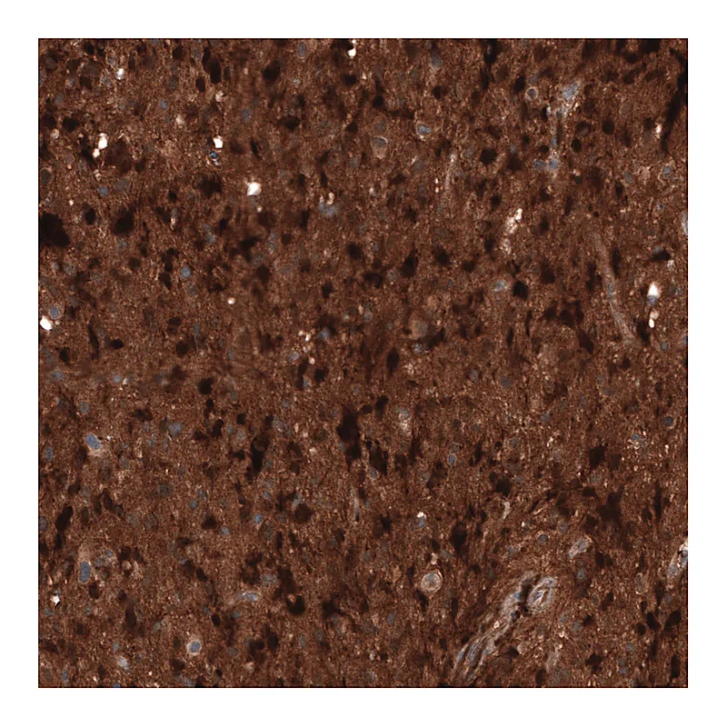 Atlas Antibodies Anti-CHI3L1 Antibody