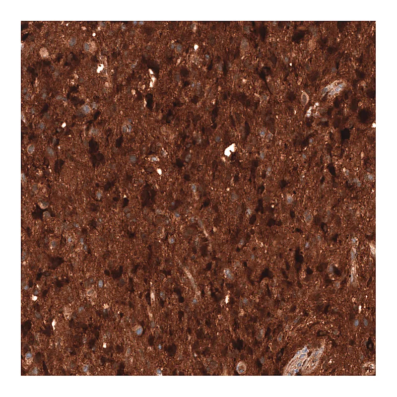 Atlas Antibodies Anti-CHI3L1 Antibody