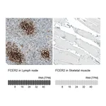 Atlas Antibodies Anti-FCER2 Antibody
