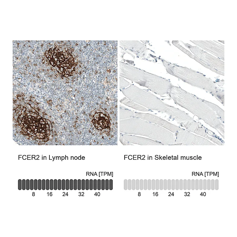 Atlas Antibodies Anti-FCER2 Antibody