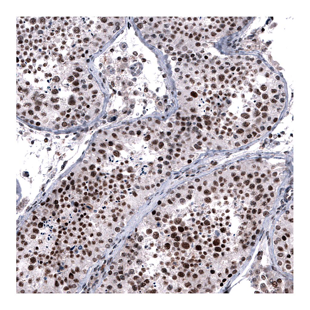 Atlas Antibodies Anti-FOXM1 Antibody