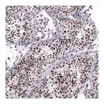 Atlas Antibodies Anti-FOXM1 Antibody