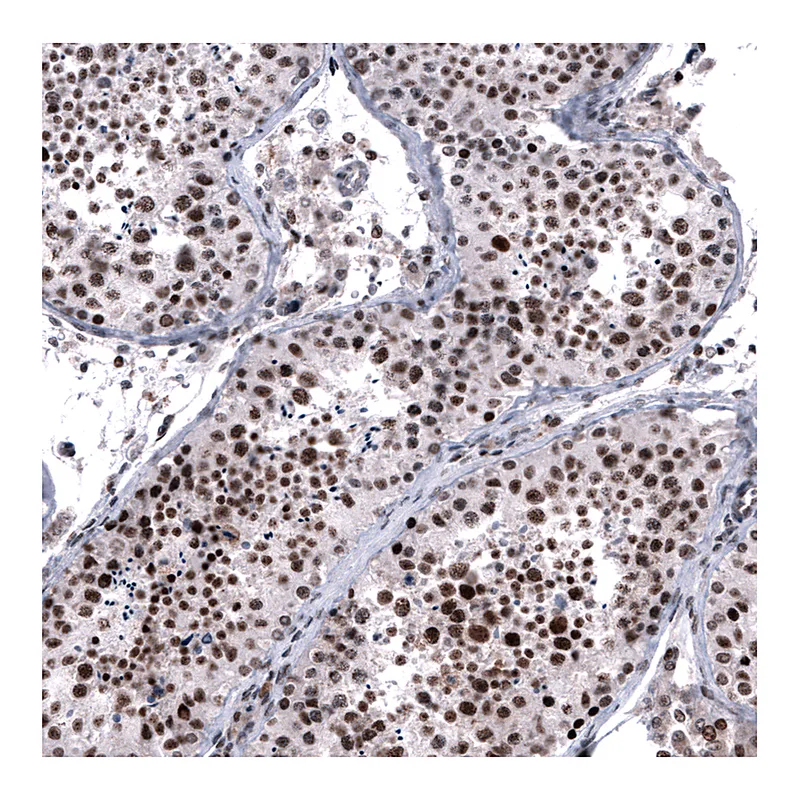 Atlas Antibodies Anti-FOXM1 Antibody