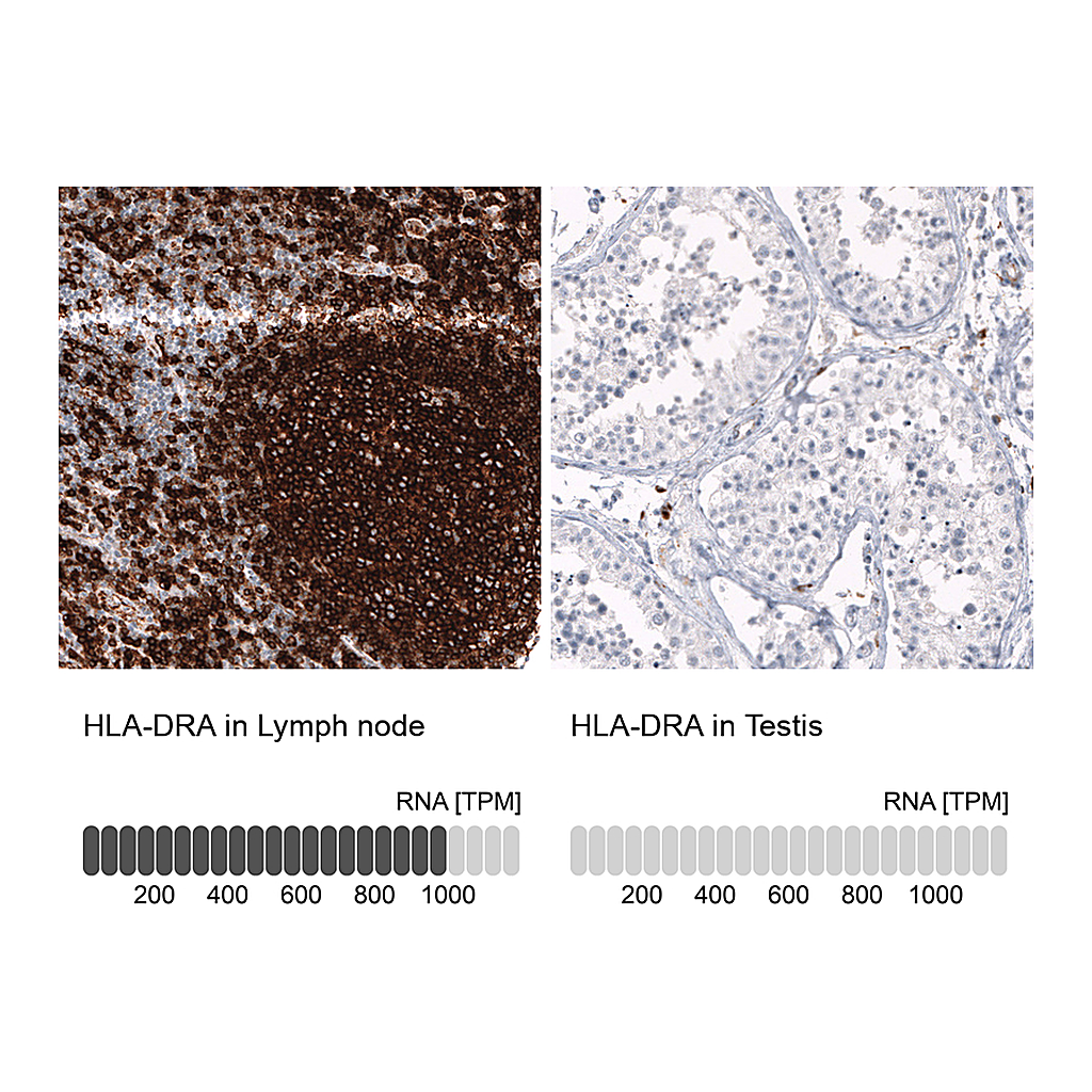 Atlas Antibodies Anti-HLA-DRA Antibody