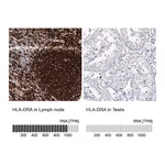 Atlas Antibodies Anti-HLA-DRA Antibody