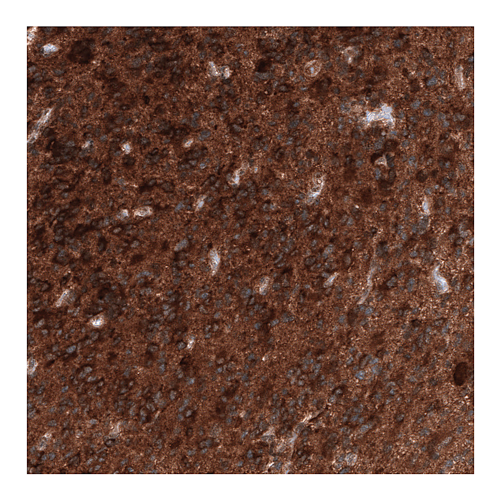 Atlas Antibodies Anti-ID1 Antibody