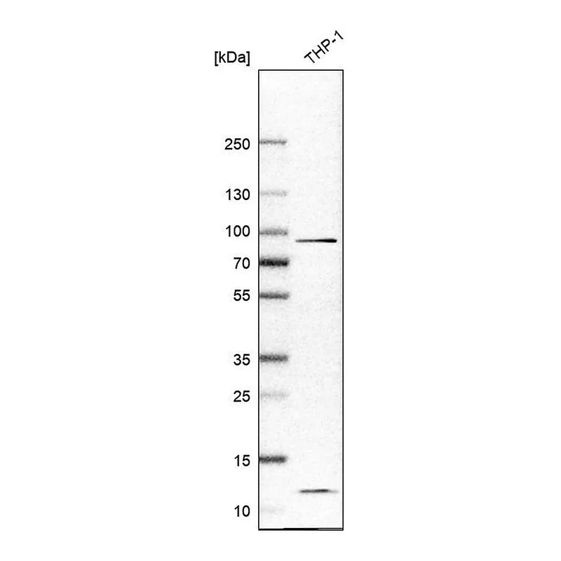 Atlas Antibodies Anti-IL17RA Antibody
