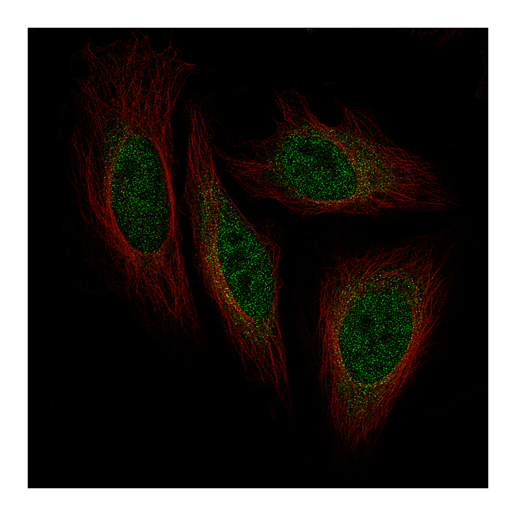 Atlas Antibodies Anti-ISL1 Antibody
