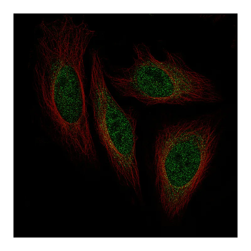 Atlas Antibodies Anti-ISL1 Antibody