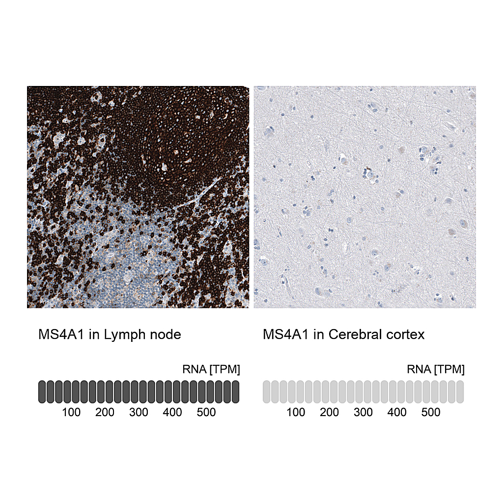 Atlas Antibodies Anti-MS4A1 Antibody