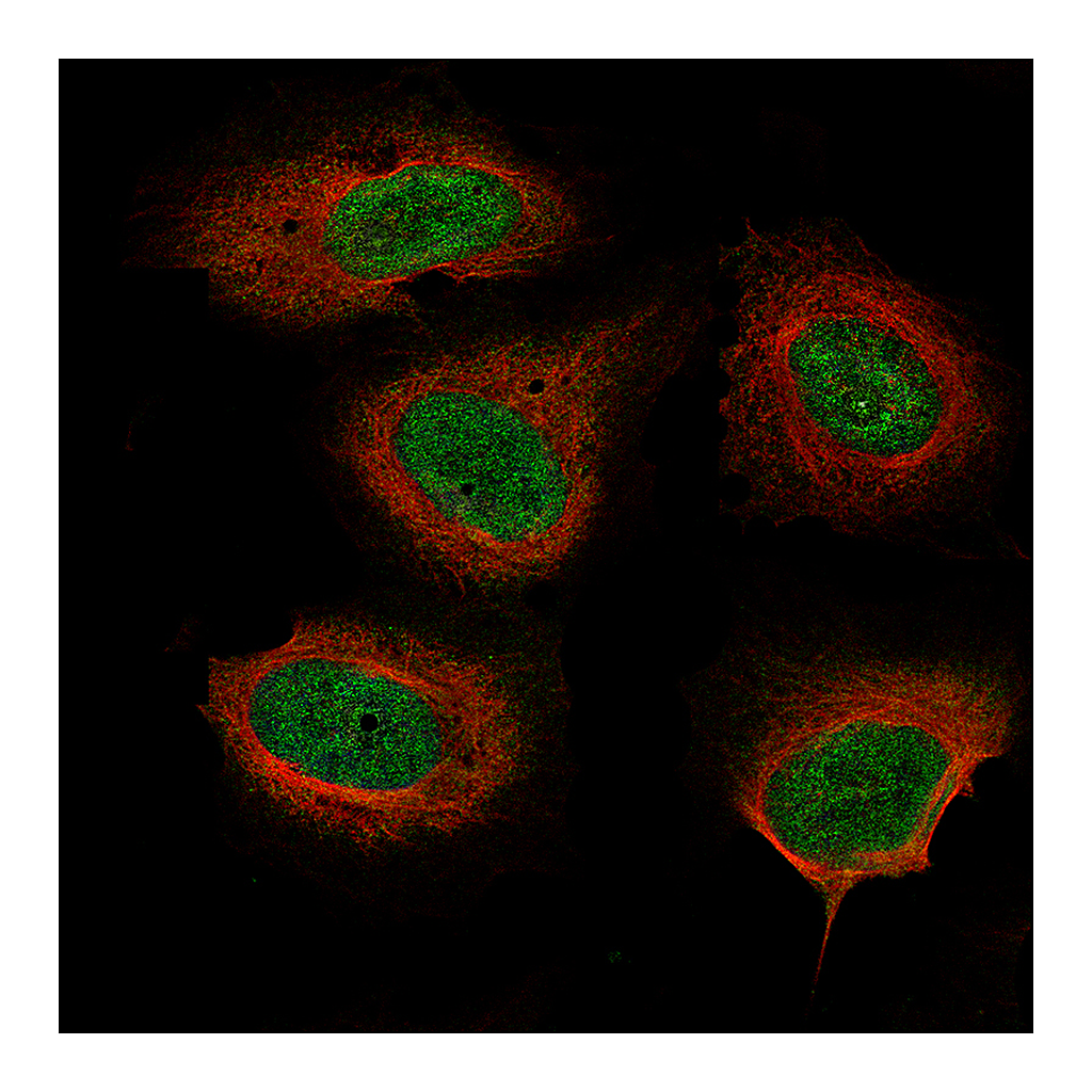 Atlas Antibodies Anti-NF1 Antibody