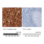 Atlas Antibodies Anti-PLP1 Antibody