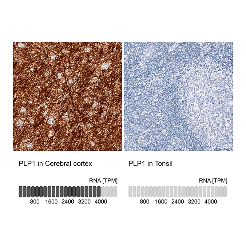 Atlas Antibodies Anti-PLP1 Antibody
