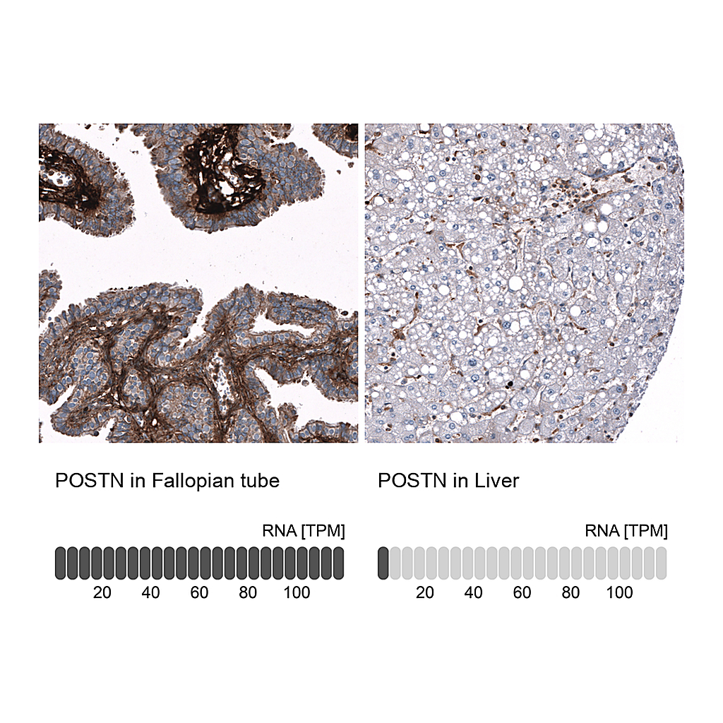 Atlas Antibodies Anti-POSTN Antibody