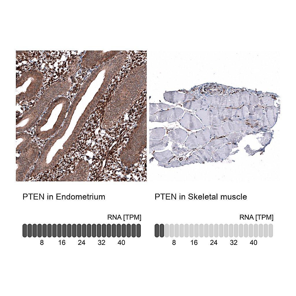 Atlas Antibodies Anti-PTEN Antibody