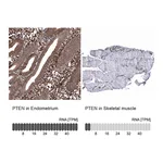 Atlas Antibodies Anti-PTEN Antibody