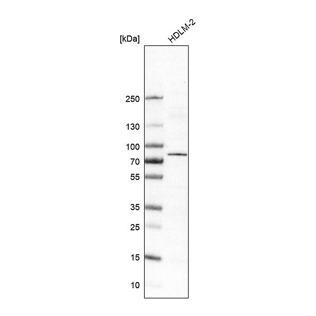 Atlas Antibodies Anti-RIPK1 Antibody