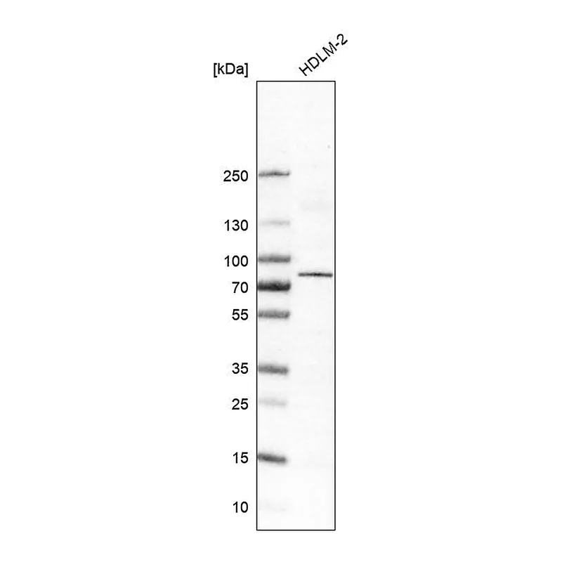 Atlas Antibodies Anti-RIPK1 Antibody