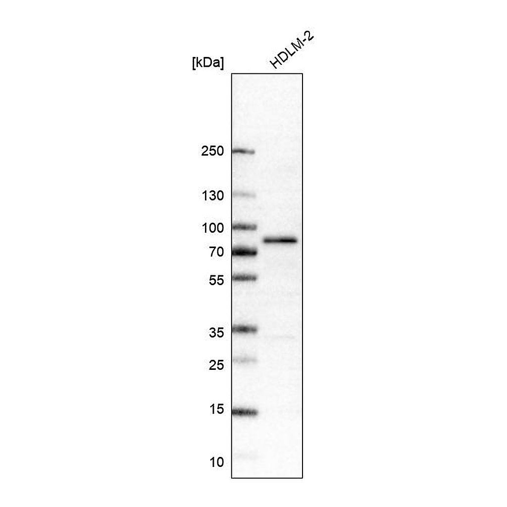 Atlas Antibodies Anti-RIPK1 Antibody