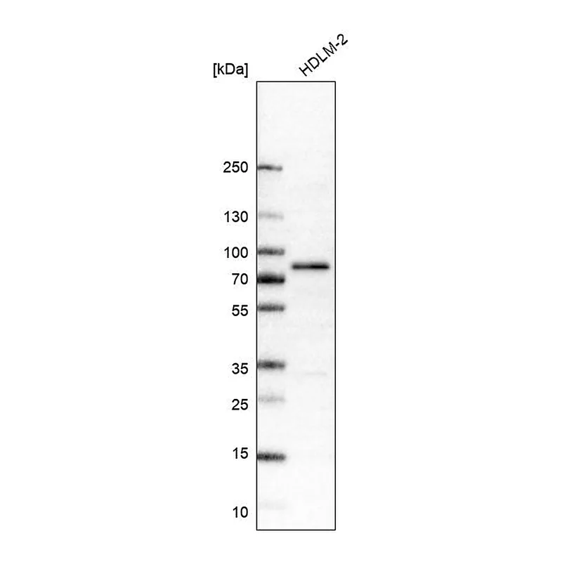 Atlas Antibodies Anti-RIPK1 Antibody