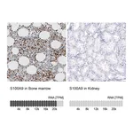Atlas Antibodies Anti-S100A9 Antibody