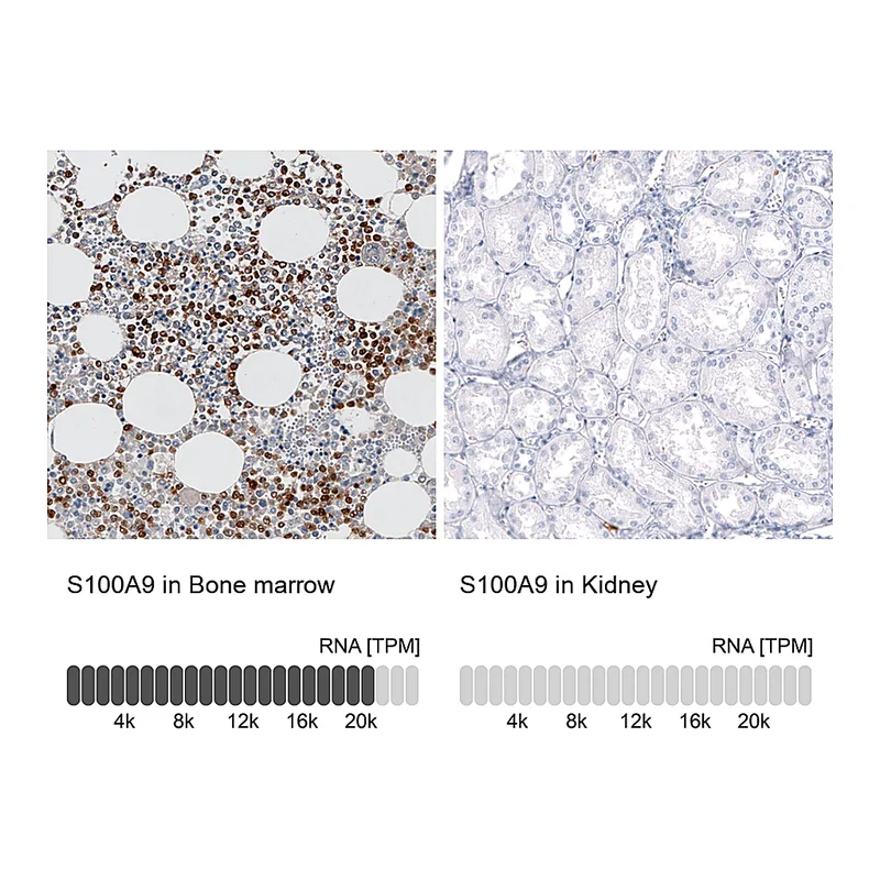 Atlas Antibodies Anti-S100A9 Antibody