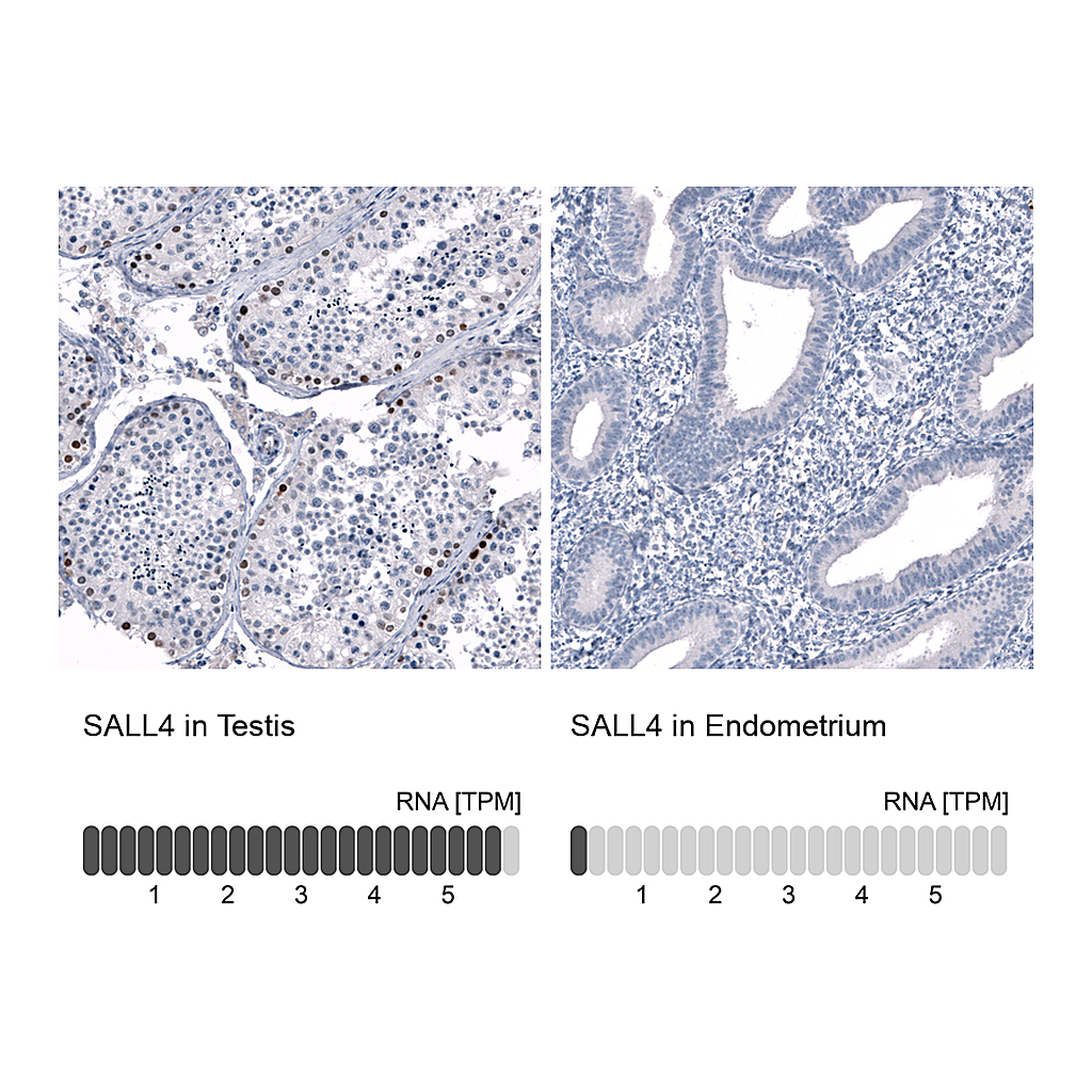 Atlas Antibodies Anti-SALL4 Antibody