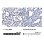 Atlas Antibodies Anti-SALL4 Antibody
