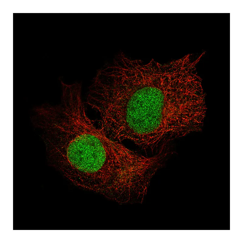 Atlas Antibodies Anti-SALL4 Antibody