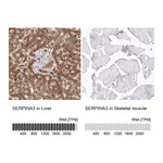 Atlas Antibodies Anti-SERPINA3 Antibody
