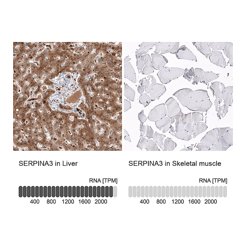 Atlas Antibodies Anti-SERPINA3 Antibody